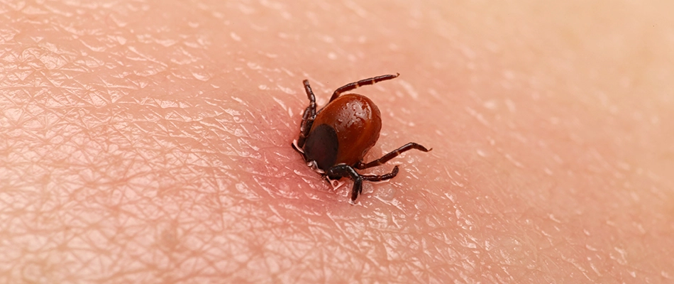 Tick entering someones skin in Downingtown, PA.