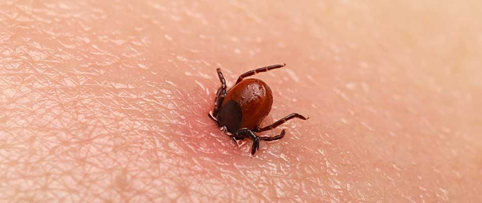 A tick burrowing into skin near West Chester, PA.